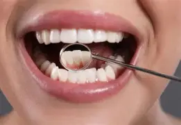 Oral Cancer Treatment