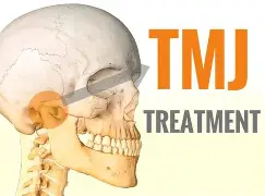 TMJ Treatment